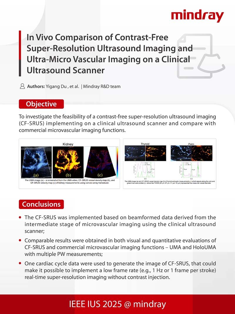 Mindray Innovation Research Debuts at IEEE International Ultrasound Conference