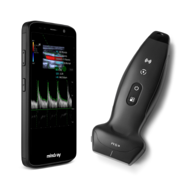 Mindray TE Air e5M Wireless handheld ultrasound system